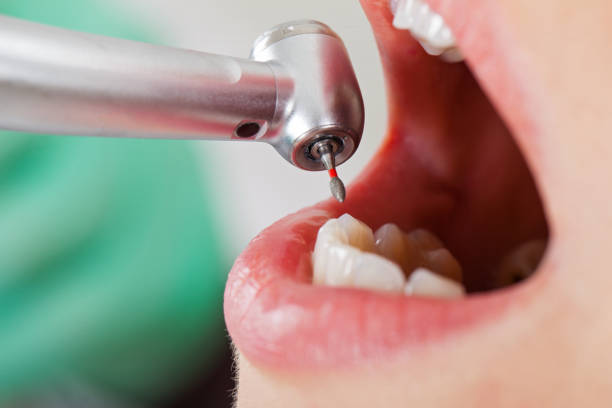 Best Tooth Infection Emergency Dentist  in Canton, GA
